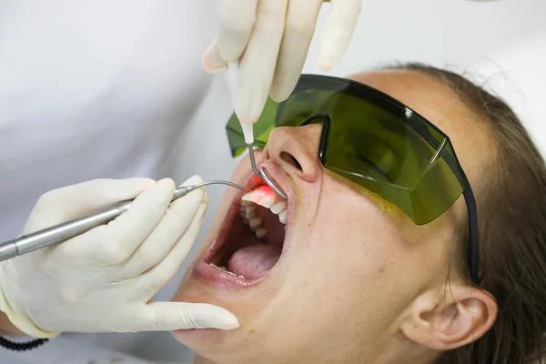 How Laser Dentistry Improves Implant Healing and Maintenance