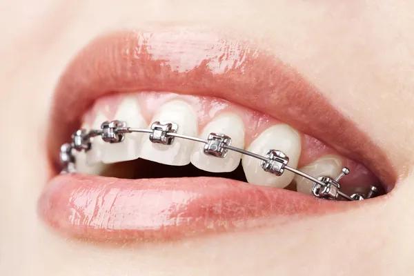 Personalized Services at Thrive Dental and Orthodontics Dallas